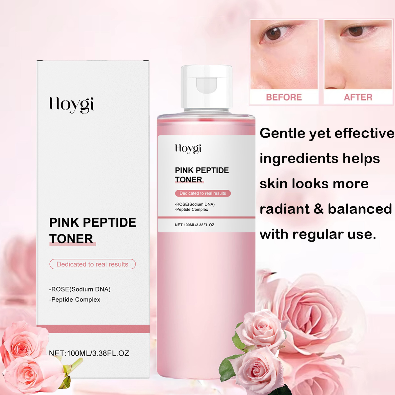Lactic Acid Toner - Rose Essence Toner Glowing Skin Soothing