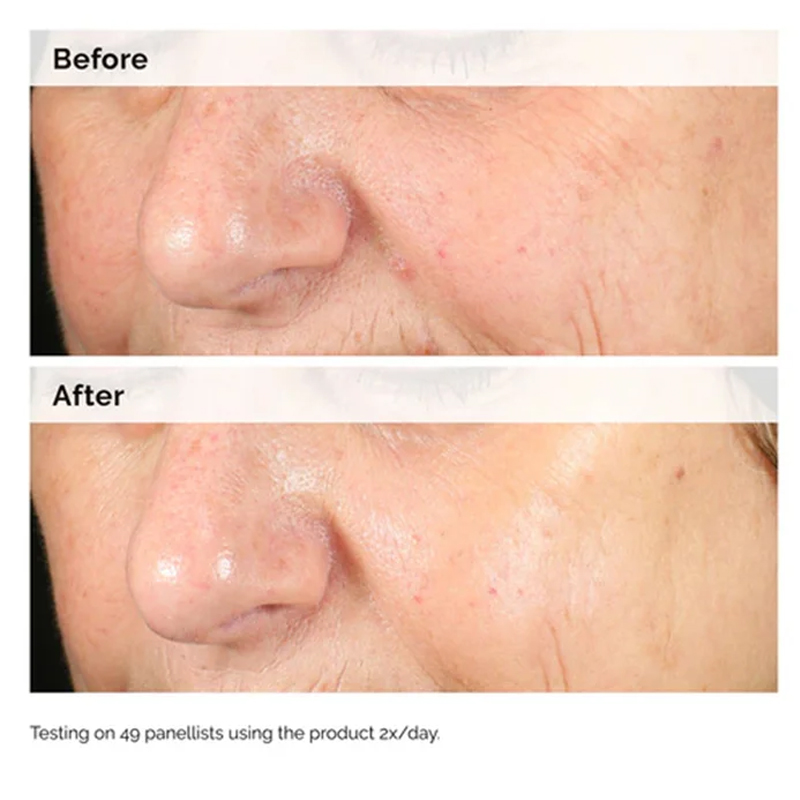 Alpha Arbutin 2% + HA 30ml Ser – Lactic Acid Toner recenzja i cena