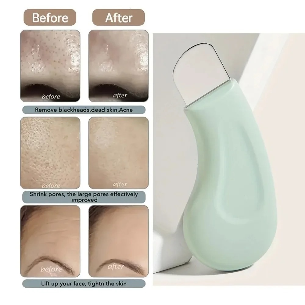 Deep Cleansing Blackhead White – Skincare Scora recenzja i cena