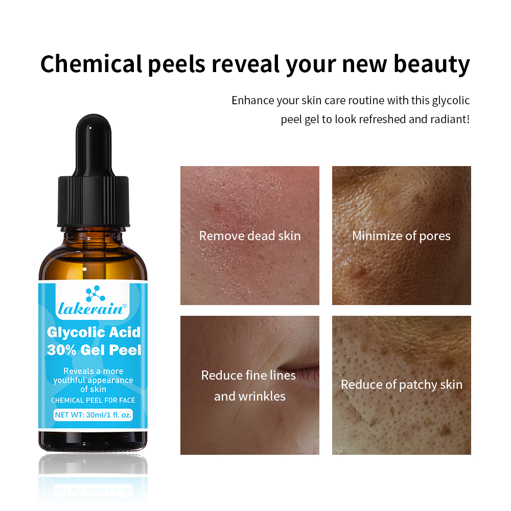 30% Glycolic Acid Peel Gel Pro – Lactic Acid Toner recenzja i cena