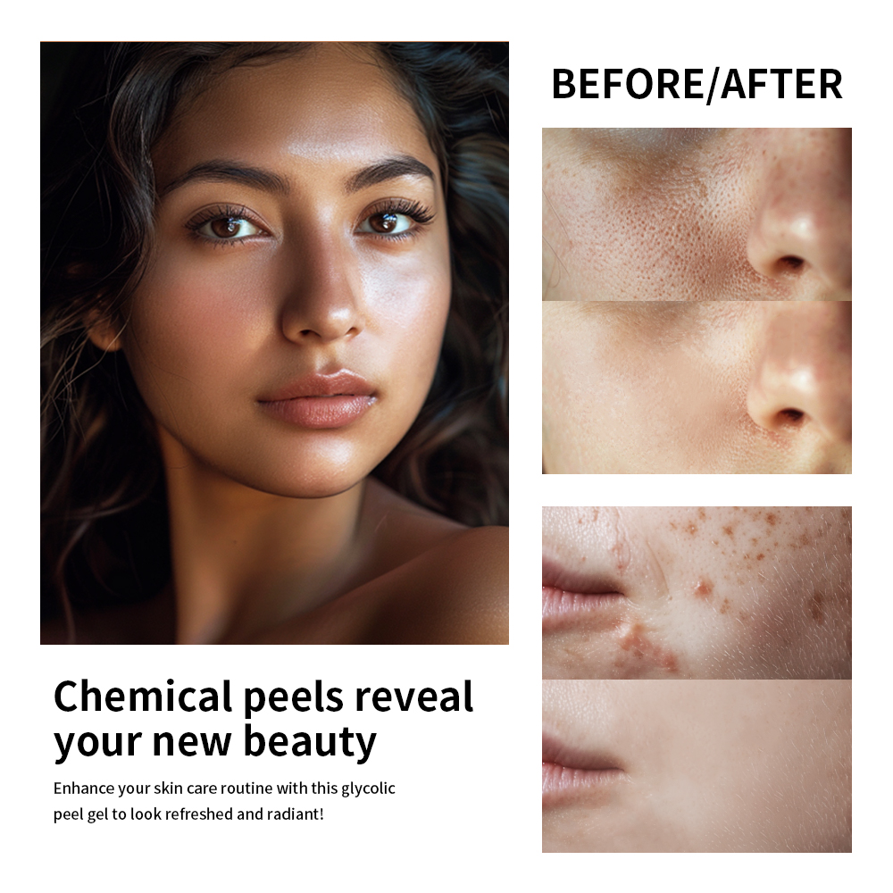 30% Glycolic Acid Face Care Lo – Lactic Acid Toner recenzja i cena