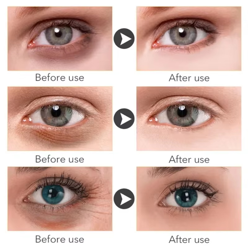 Anti Dark Circle Eye Serum Oil – Hyaluronic Acid Serum recenzja i cena
